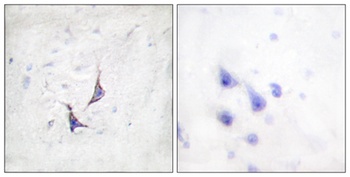 Syndecan-4 rabbit pAb Antibody