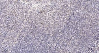 SH2D4A rabbit pAb Antibody
