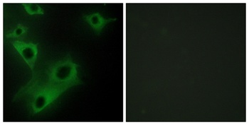 CIDE-3 rabbit pAb Antibody