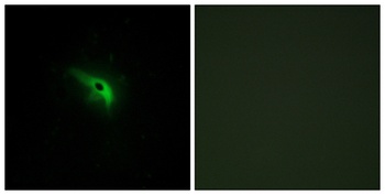 p53AIP1 rabbit pAb Antibody