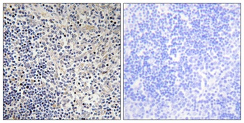 p53AIP1 rabbit pAb Antibody