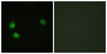 BLM (phospho Thr99) rabbit pAb Antibody