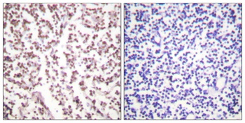 BLM rabbit pAb Antibody