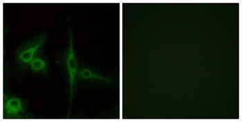 ETL rabbit pAb Antibody