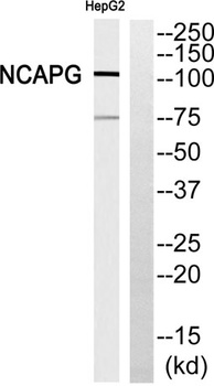 hCAP-G rabbit pAb Antibody