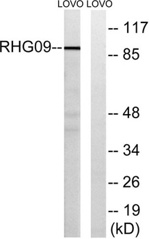 ARHGAP9 rabbit pAb Antibody