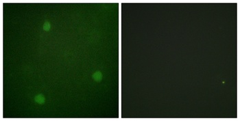 Artemis rabbit pAb Antibody