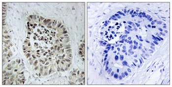 Artemis rabbit pAb Antibody