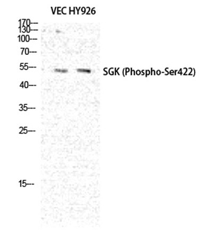 SGK1 (phospho Ser422) rabbit pAb Antibody