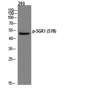 SGK1 (phospho Ser78) rabbit pAb Antibody