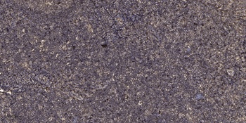 SGK1 (phospho Ser78) rabbit pAb Antibody