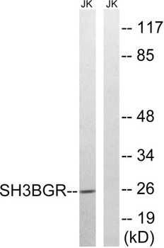 SH3BGR rabbit pAb Antibody