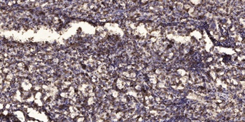 SH3BGR rabbit pAb Antibody