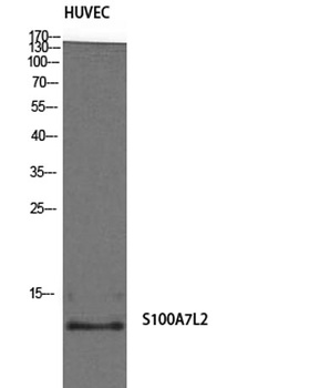 S-100A7L2 rabbit pAb Antibody