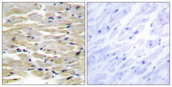 Tensin3 rabbit pAb Antibody
