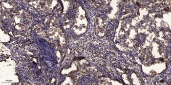 Ran BP-17 rabbit pAb Antibody