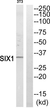 Six1 rabbit pAb Antibody