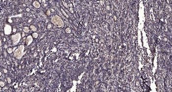 Six1 rabbit pAb Antibody