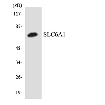 GABA T-1 rabbit pAb Antibody