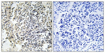 p47-phox (phospho Ser359) rabbit pAb Antibody