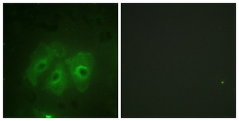p47-phox (phospho Ser359) rabbit pAb Antibody