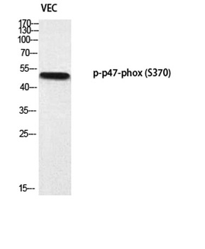 p47-phox (phospho Ser370) rabbit pAb Antibody