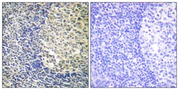 p47-phox (phospho Ser370) rabbit pAb Antibody