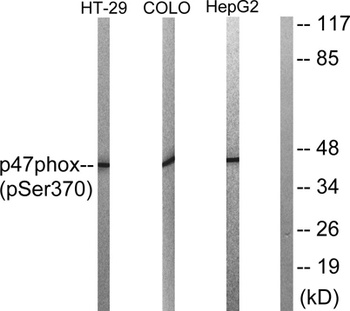 p47-phox (phospho Ser370) rabbit pAb Antibody