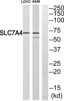 CAT-4 rabbit pAb Antibody