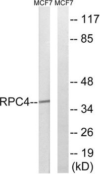 POLR3D rabbit pAb Antibody