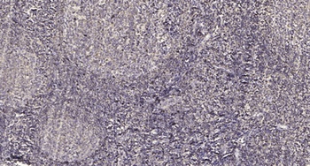 POLR3D rabbit pAb Antibody