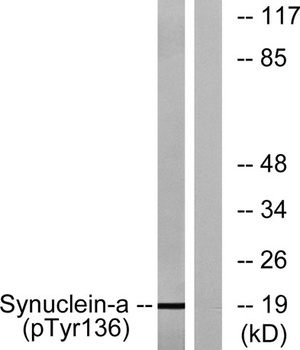 Synuclein-α (phospho Tyr136) rabbit pAb Antibody