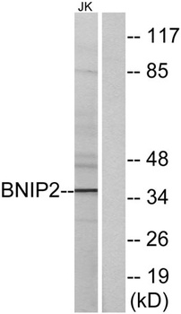 BNIP-2 rabbit pAb Antibody