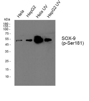 Sox-9 (phospho Ser181) rabbit pAb Antibody