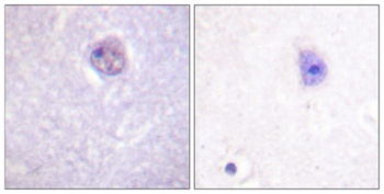 Sox-9 (phospho Ser181) rabbit pAb Antibody