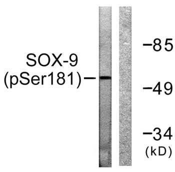 Sox-9 (phospho Ser181) rabbit pAb Antibody