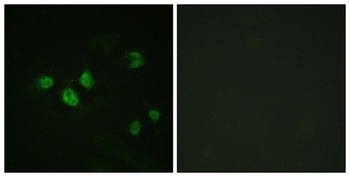 Sp1 (phospho Thr453) rabbit pAb Antibody