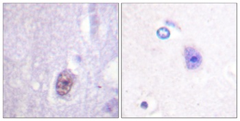 Sp1 (phospho Thr453) rabbit pAb Antibody