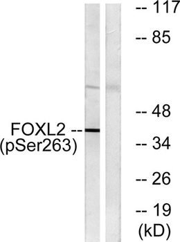FoxL2 (phospho Ser263) rabbit pAb Antibody
