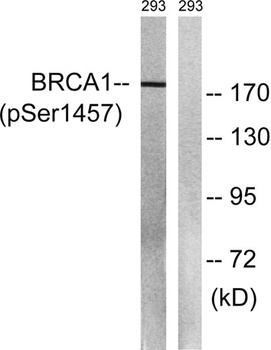 BRCA1 (phospho Ser1457) rabbit pAb Antibody