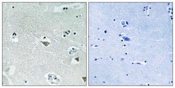 SREBP-1 (phospho Ser439) rabbit pAb Antibody