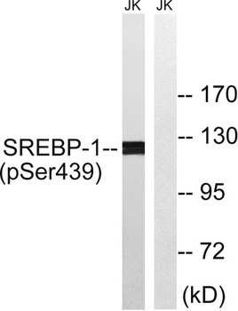SREBP-1 (phospho Ser439) rabbit pAb Antibody