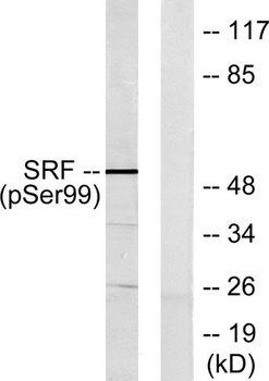 SRF (phospho Ser103) rabbit pAb Antibody
