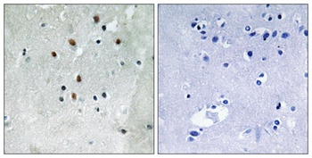 SRF (phospho Ser77) rabbit pAb Antibody