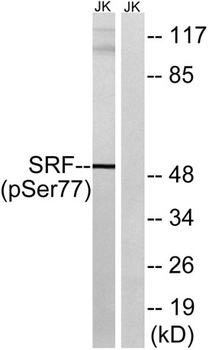 SRF (phospho Ser77) rabbit pAb Antibody