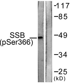 SSB (phospho Ser366) rabbit pAb Antibody