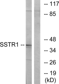 SSTR1 rabbit pAb Antibody