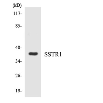 SSTR1 rabbit pAb Antibody