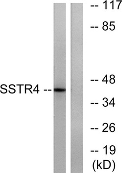 SSTR4 rabbit pAb Antibody