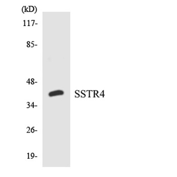 SSTR4 rabbit pAb Antibody